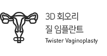 3D 회오리 질 임플란트